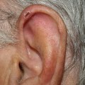 Are men's ears more sensitive?