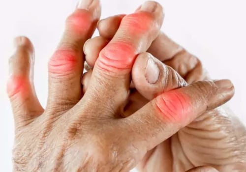 How can men reduce their risk of developing arthritis?